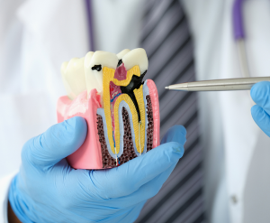 Strengthens Tooth Enamel